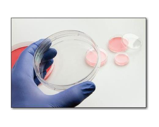 Tissue Culture dish