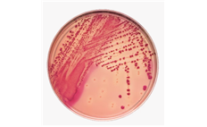 MacConkey II Agar - BBL&amp;reg; Prepared Plated Media, 100x10mm and 100x15mm Style Plates