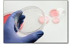 Tissue Culture dish